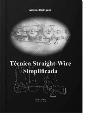 Técnica Straight - Wire Simplificada