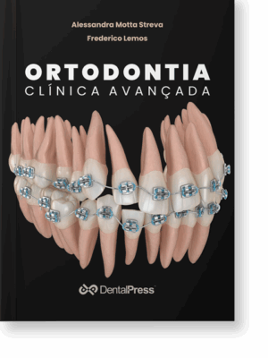 Ortodontia Clínica Avançada