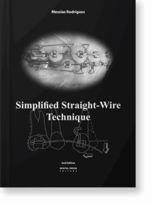 Slimplified Straight-Wire Technique(E-book)