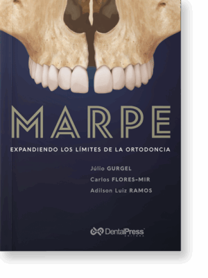 MARPE - EXPANDIENDO LOS LÍMITES DE LA ORTODONCIA