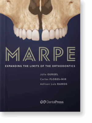 MARPE - EXPANDING THE LIMITS OF ORTHODONTICS(E-book)