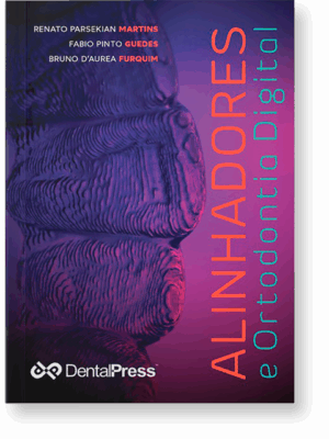 ALINHADORES e Ortodontia Digital (E-Book)