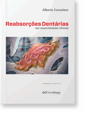 Reabsorções Dentárias nas Especialidades Clínicas
