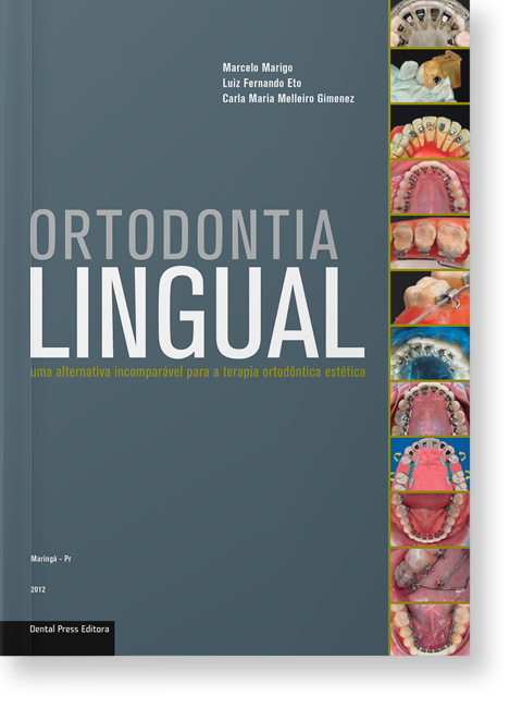 15174433389 CAPA COM SOMBRA ortodontia lingual