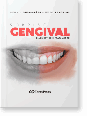 Sorriso Gengival - Dennis Guimarães e Julio Rebollal