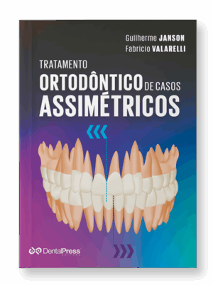 Tratamento Ortodôntico de Casos Assimétricos