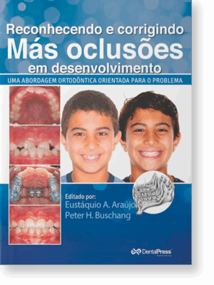 Reconhecendo e Corrigindo Más Oclusões em Desenvolvimento