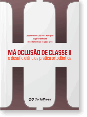 Má Oclusão de Classe II