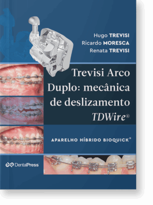 Trevisi Arco Duplo - mecânica de deslizamento TDWire