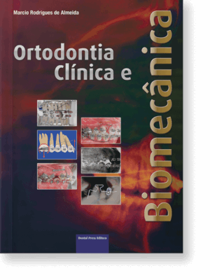 Ortodontia Clínica e Biomecânica